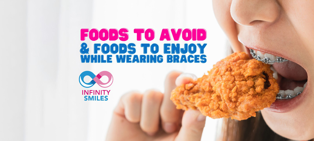 Foods to Avoid and Foods to Enjoy While Wearing Braces
