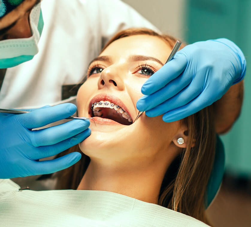 How do fixed braces work? How do fixed braces work?