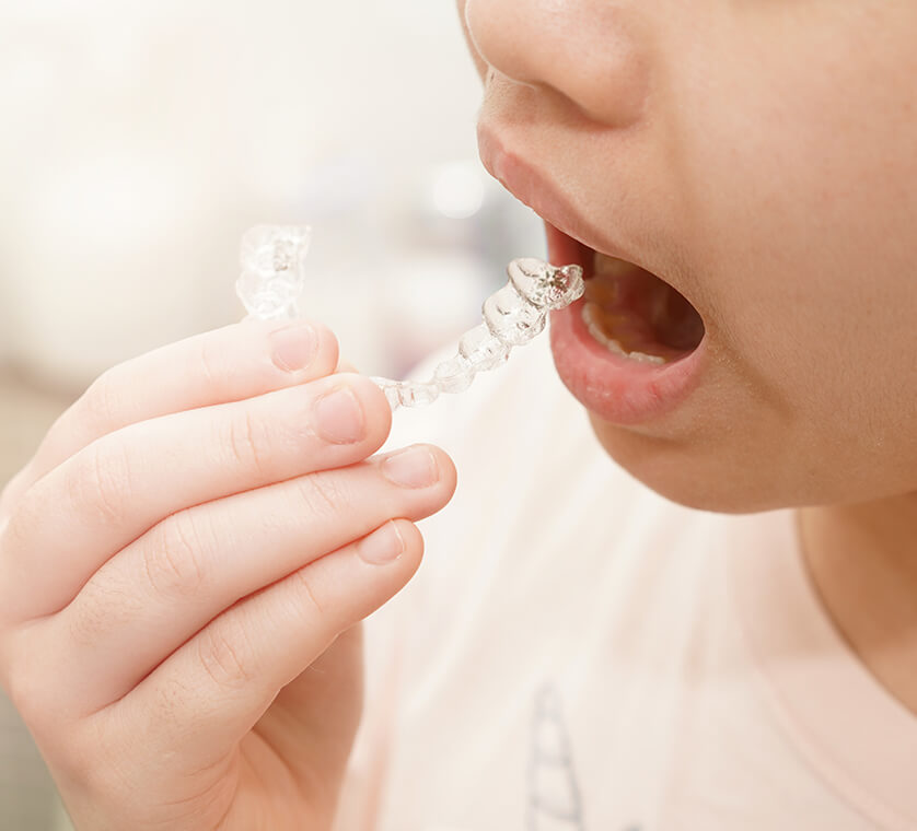 5 reasons to choose Invisalign® for kids