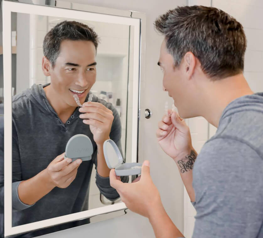 How do Spark aligners work? How do Spark aligners work?