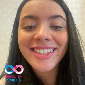 Infinity smiles